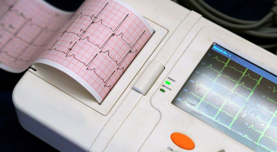 Lepsza diagnoza arytmii i zawałów serca. Naukowcy PW Lepsza diagnoza arytmii i zawałów serca. Naukowcy z PW wymyślili, jak udoskonalić EKG z użyciem sztucznej inteligencji