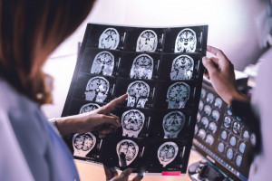 Neurolodzy z Lublina opracują model opieki nad osobami z demencją