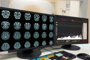 Sztuczna inteligencja w badaniach PET w Radomskim Centrum Onkologii. 