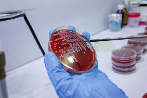 Sanepid: epidemia Legionelli na Podkarpaciu hamuje. Nadal trwa jednak dochodzenie