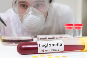 Rzeszów: już ponad 160 osób zakażonych Legionellą