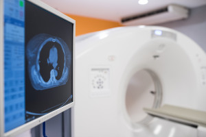 Sztuczna inteligencja w diagnostyce. Szybsze badanie i dokładniejszy obraz