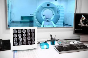Nowotwory głowy i szyi. Co roku diagnozę słyszy około 11 tys. pacjentów