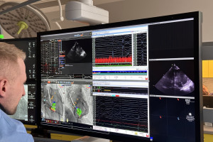 W UCK kardiolodzy wykorzystują nowoczesne metody monitorowania zabiegów. To zwiększa bezpieczeństwo pacjentów