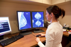 ¿Puede la inteligencia artificial ayudar a tratar el cáncer de mama?  Puede ahorrarles a los pacientes quimioterapia innecesaria