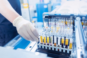 Diagności laboratoryjni chcą oddzielnie kontraktować świadczenia z NFZ
