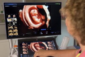 Katowice: ruszyły badania prenatalne "na NFZ" jednym z najlepszych aparatów USG na świecie