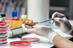 Naukowcy z GUMed pracują nad innowacyjną diagnostyką sepsy. Projekt kosztuje prawie 1,8 mln zł