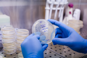 15 akredytowanych ośrodków. Terapia CAR-T ratuje życie, a otrzymuje ją najwyżej jedna trzecia chorych