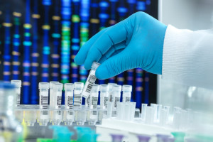 Onkoloji hastaları için yeni bir garantili fayda. Çalışma listesindeki proje.