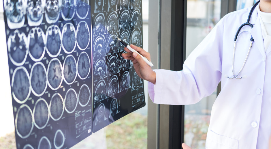 Lepsze leczenie udaru mózgu. Eksperci: rehabilitacja wciąż daleko w tyle