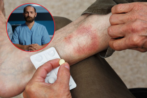 I medici di base lanciano l'allarme. Il numero di casi è aumentato di quasi il 30%.