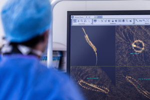 GE HealthCare Polonya CEO'su: En yeni kardiyak tanı cihazları birçok yeniliği beraberinde getiriyor