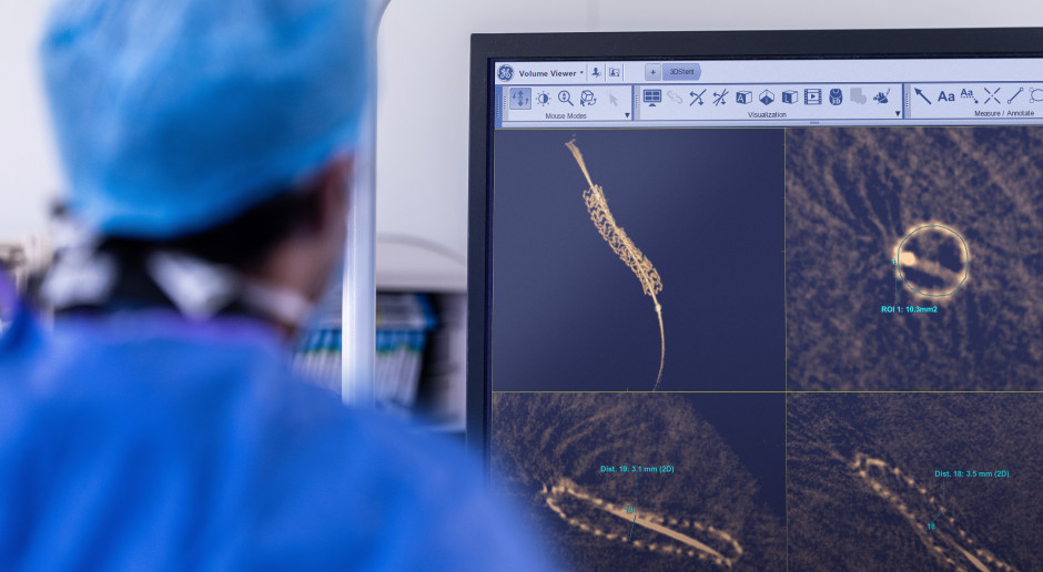 Dyrektor generalna GE HealthCare Poland: najnowsze urządzenia diagnostyki kardiologicznej przynoszą wiele innowacji