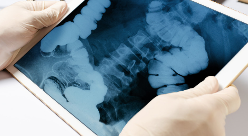 Dewastuje jelita, zmienia życie w piekło. Lekarze ostrzegają: zaczyna się niewinnie