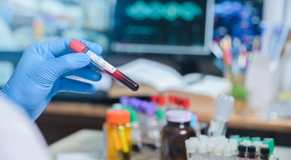 Rośnie liczba nowych zakażeń HIV. Eksperci apelują o krajowy program profilaktyki PrEP