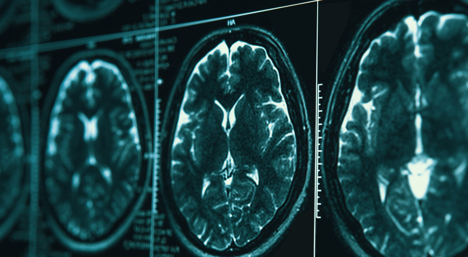 Naukowiec od lat bada inteligencję. Mówi, co bezpowrotnie zmienia nasz mózg