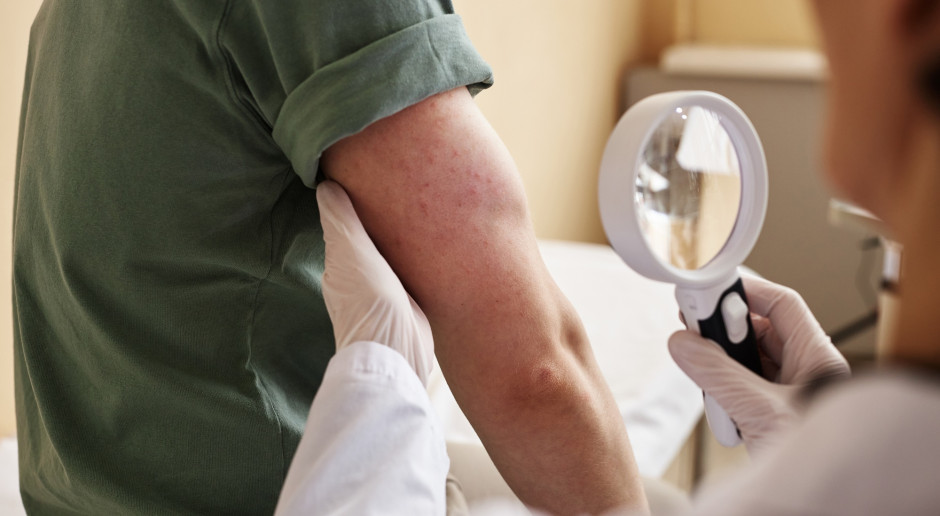 Sukces na skalę Europy: 5 lat polskiego modelu opieki dla pacjentów z neurofibromatozami