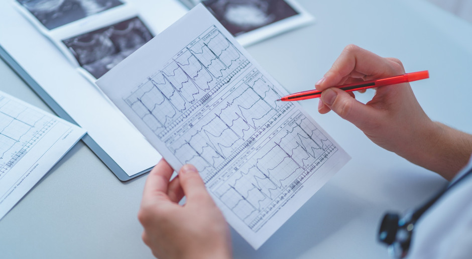 Wskaźniki jakości opieki kardiologicznej. Ministerstwo Zdrowia ujawniło projekt