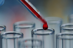 Chemioterapia bez krwi? Często to niemożliwe. Lekarze apelują o wsparcie