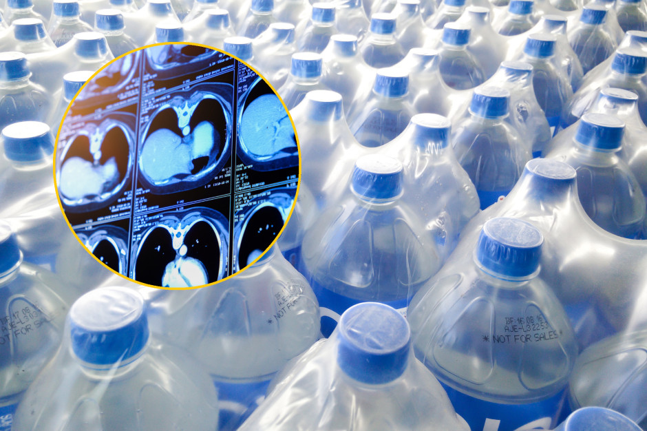 Toksyczne dla wątroby. Naukowcy: komórki obumierają - zmiany są nieodwracalne