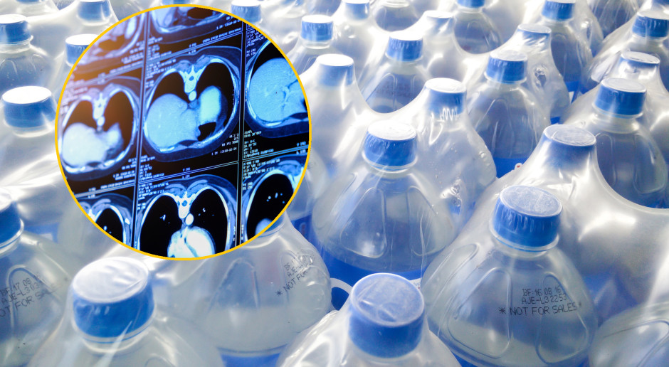 Toksyczne dla wątroby. Naukowcy: komórki obumierają - zmiany są nieodwracalne