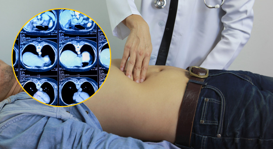 Polacy nie mają umiaru. Już jeden tygodniowo sieje spustoszenie w wątrobie