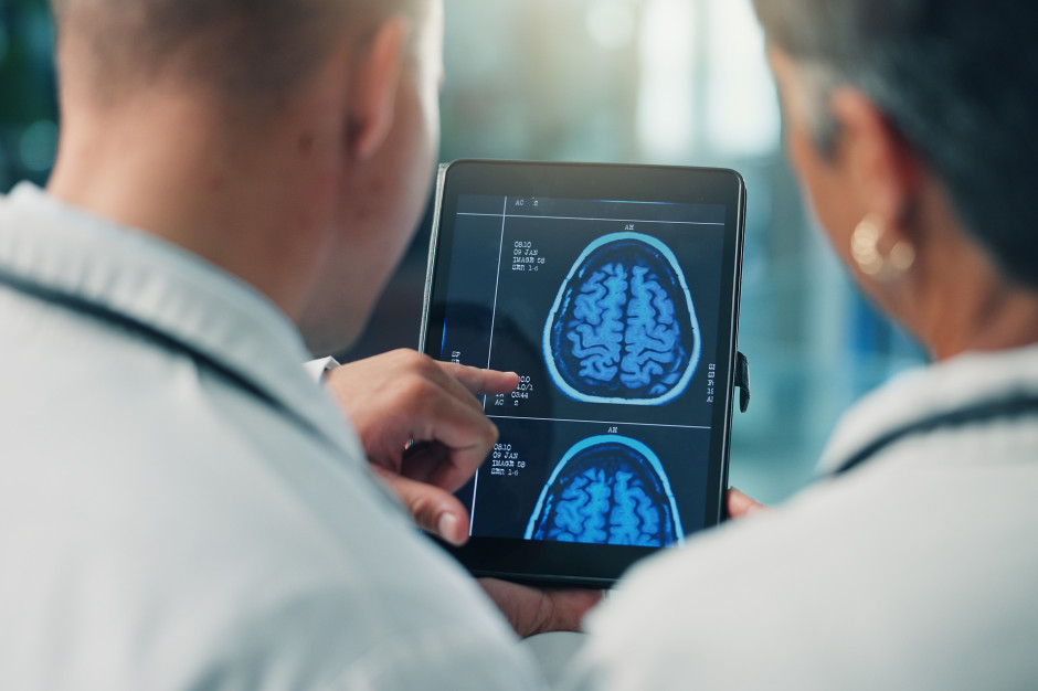 Spowalnia starzenie mózgu choćby o 8 lat. Badacze: zmniejsza ryzyko alzheimera