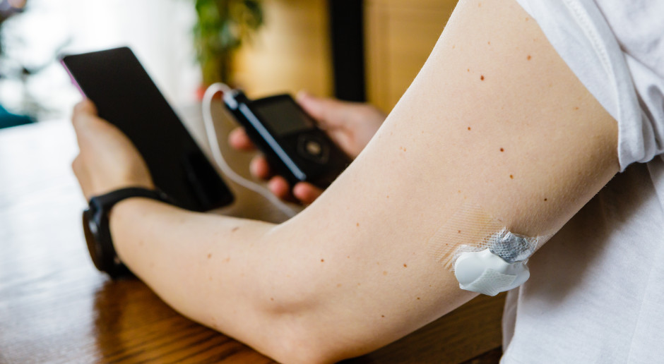 Co dalej z pompami insulinowymi po 26 roku życia? Jest mglista odpowiedź MZ