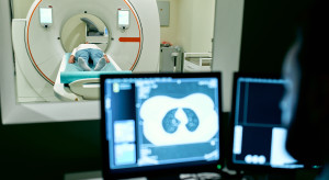 Nowe taryfy badań TK i MR od 2026 r. Zmiany obejmą też onkologię i wirtualną kolonoskopię