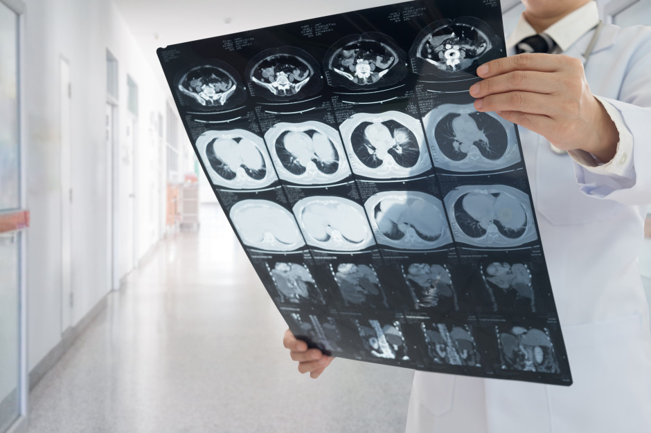 5 lat wystarczyło, by całkowicie cofnąć marskość wątroby. Jedna zmiana