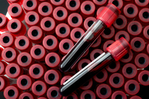 Naukowcy odkryli, co dzieje się z krwią w kosmosie. Zmiany już po kilku dniach