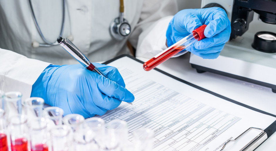 Nie ma bezpiecznego poziomu ołowiu. MZ przedstawia projekt nowych norm