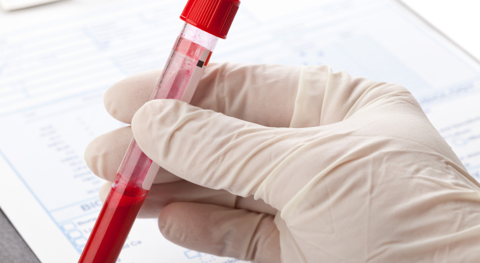 To dlatego nie możesz schudnąć. Najsilniejszy przeciwnik odchudzania