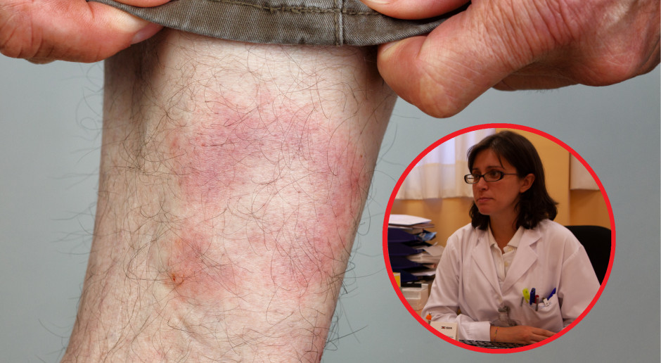 Coraz więcej pacjentów u lekarzy POZ. Nadchodzi armagedon