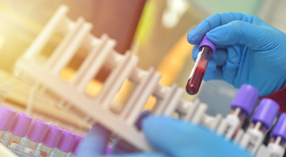 Cholesterol to za mało. Ten wskaźnik lepiej przewiduje zawał i udar