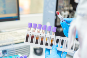 Hemofilia bez barier? Postęp jest ogromny, ale nie dla wszystkich pacjentów