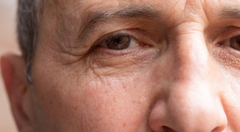 Skraca życie o 10 lat. Pierwszy objaw widać na nosie