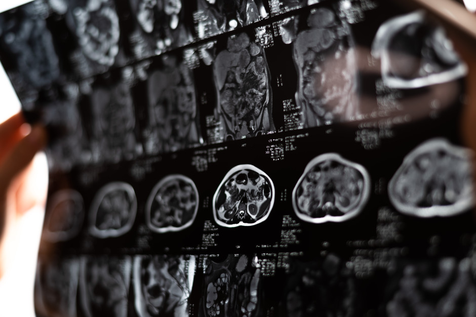 Odmładza i regeneruje wątrobę. Klucz, by cofnąć zniszczenia