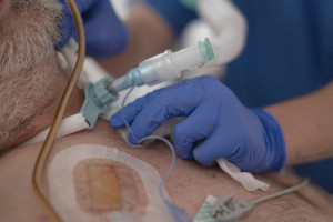 Do Kielc przylecieli nawet Japończycy. W centrum onkologii wszczepiają protezy głosowe