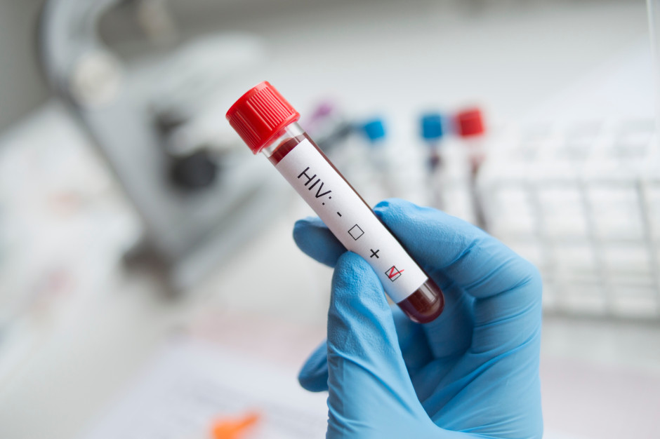 Nie będzie Krajowego Centrum ds. AIDS. W to miejsce powstanie inny ośrodek
