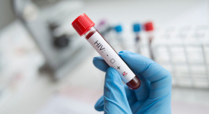 Nie będzie Krajowego Centrum ds. AIDS. W to miejsce powstanie inny ośrodek