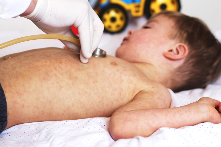Ponad 40 tys. zachorowań i 50 potwierdzonych zgonów. Pakistan mierzy się z epidemią tej groźnej choroby