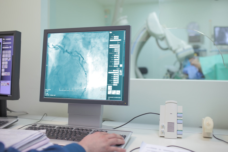 Spór kardiologów i radiologów o opisywanie badań serca. Mamy dane, które mogą go zakończyć