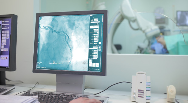 Spór kardiologów i radiologów o opisywanie badań serca. Dane, które mogą go zakończyć