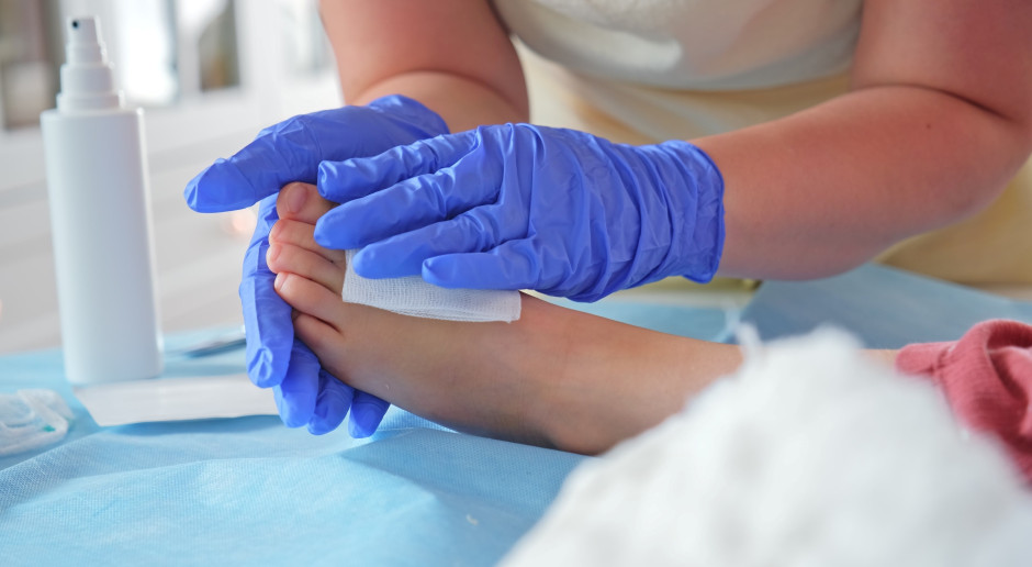 Aplikacja Nieamputuj.pl wspiera diagnozę stopy cukrzycowej