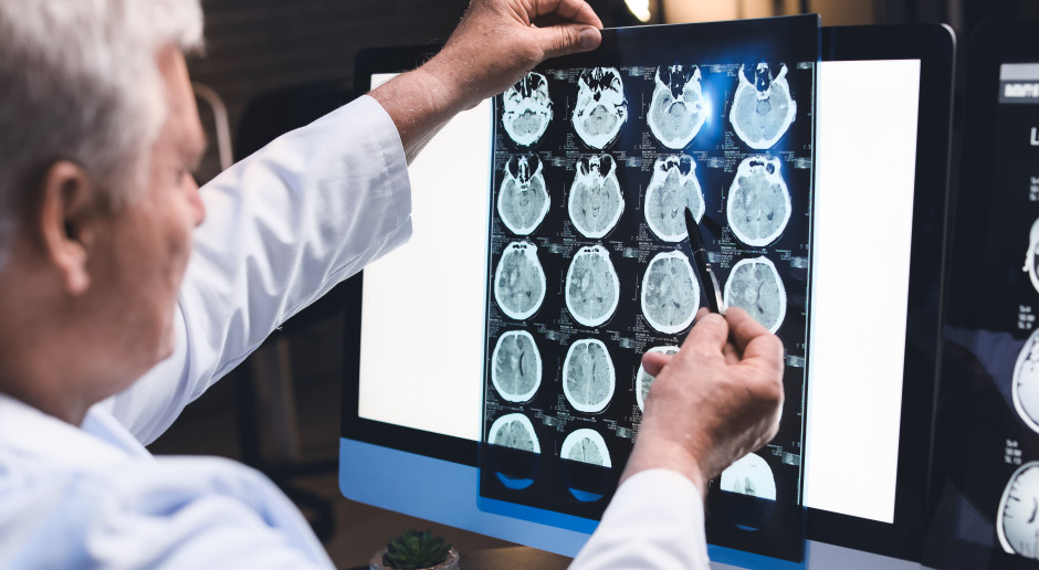 Glejak: neurochirurg o długości życia i sposobach leczenia
