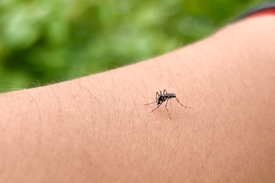 Komary omijają szerokim łukiem. Specjalista zdradził prosty trik