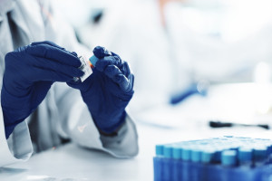 Jedna cząsteczka może hamować mechanizmy choroby Alzheimera. Oddziałuje na uszkodzenia DNA