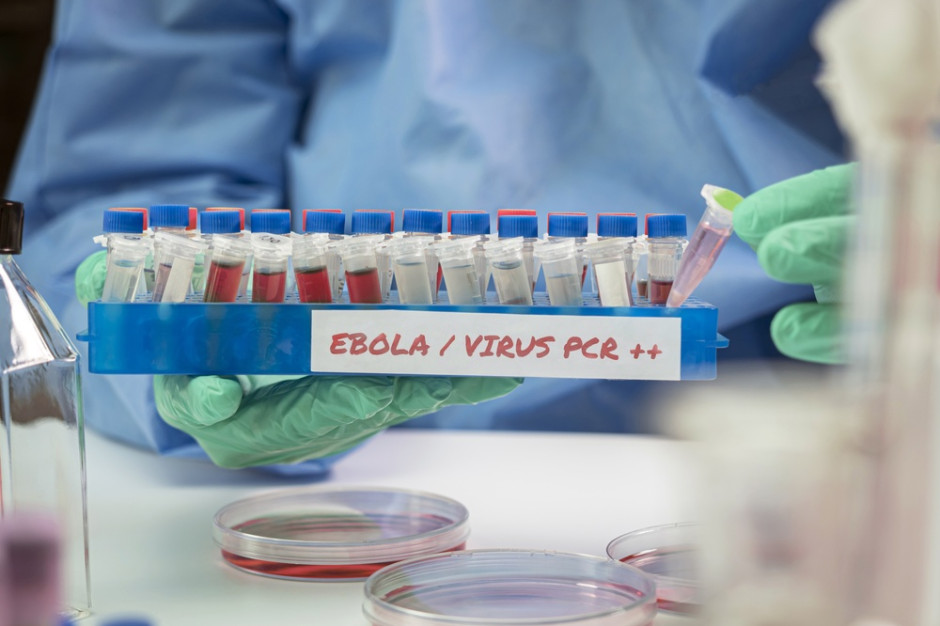 Potwierdzono ponad 2 tysiące zgonów z powodu eboli. To największa epidemia w historii Konga
